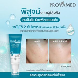 10PRwfOVAMED